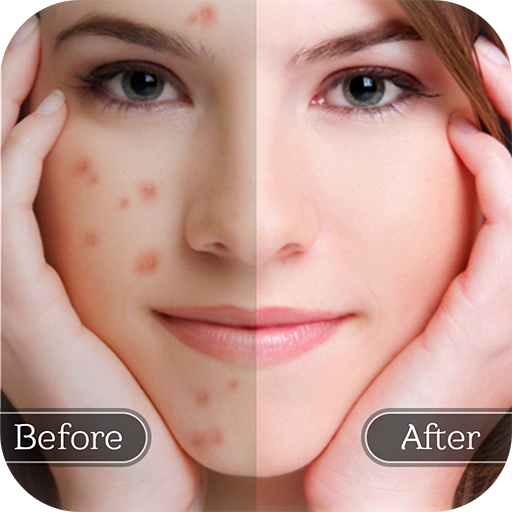 Face Blemish Remover - Smooth